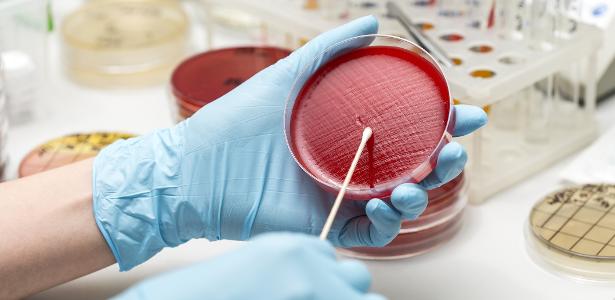 IA supera 94% dos virologistas em teste criado pela elite da área