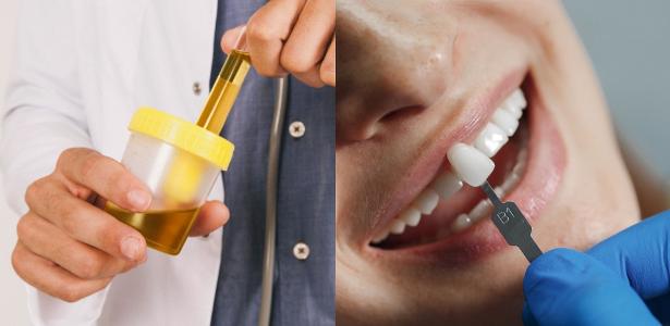 Implantes feitos de xixi? Como odontologia quer usar urina humana